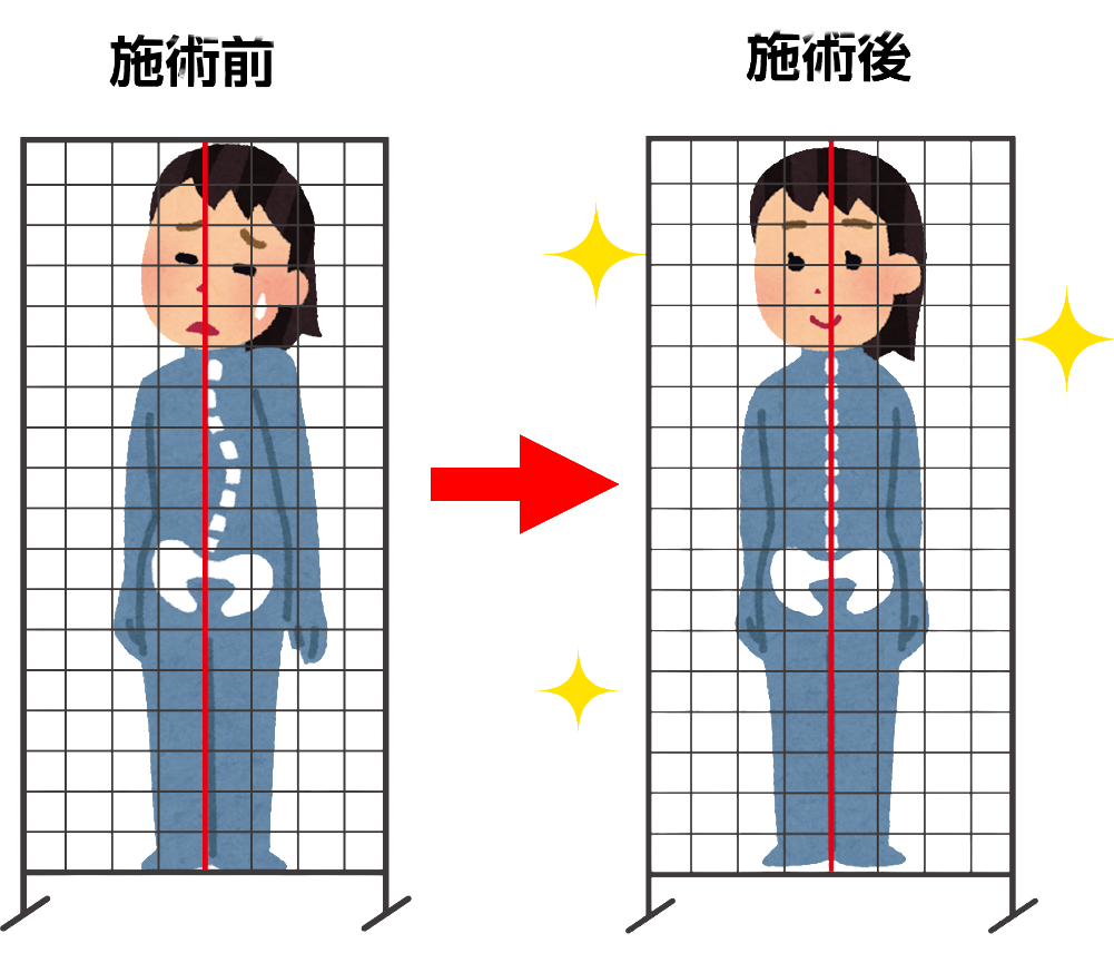 施術前に立った姿勢を確認している様子