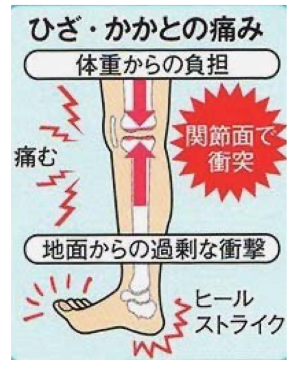 ひざ・かかとの痛みの図