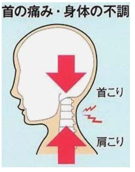 首の痛み・身体の不調の図